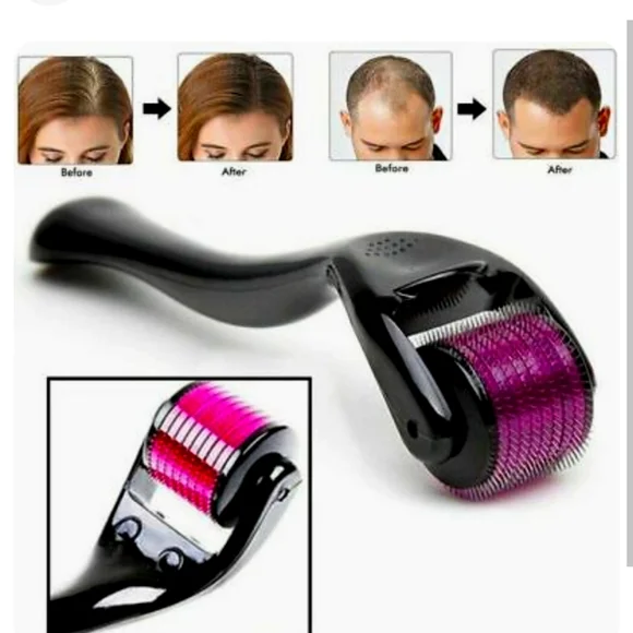 Derma Roller for Hair Loss Beard Growth 0.5-2.0mm Microneedle Dermaroller US - Picture 2 of 4